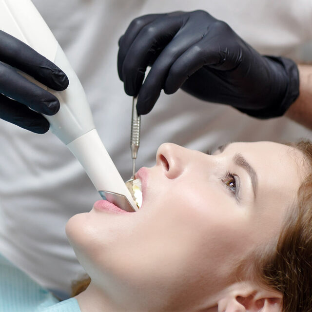 Scanner Intraorale Primo Centri Dentistici