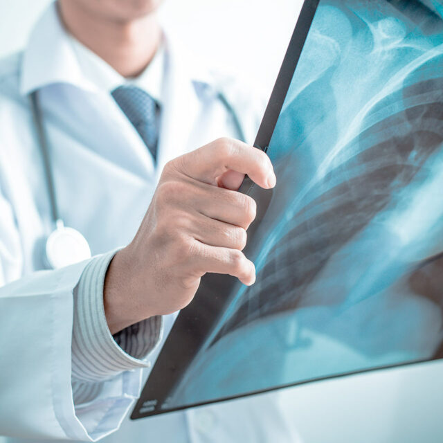 Primo Centri Medici Visita Ortopedia Radiografia Ortopedico