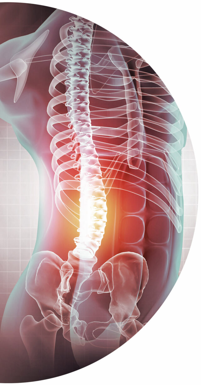 Primo Centri Medici Visita Ortopedia Colonna Infiammazione